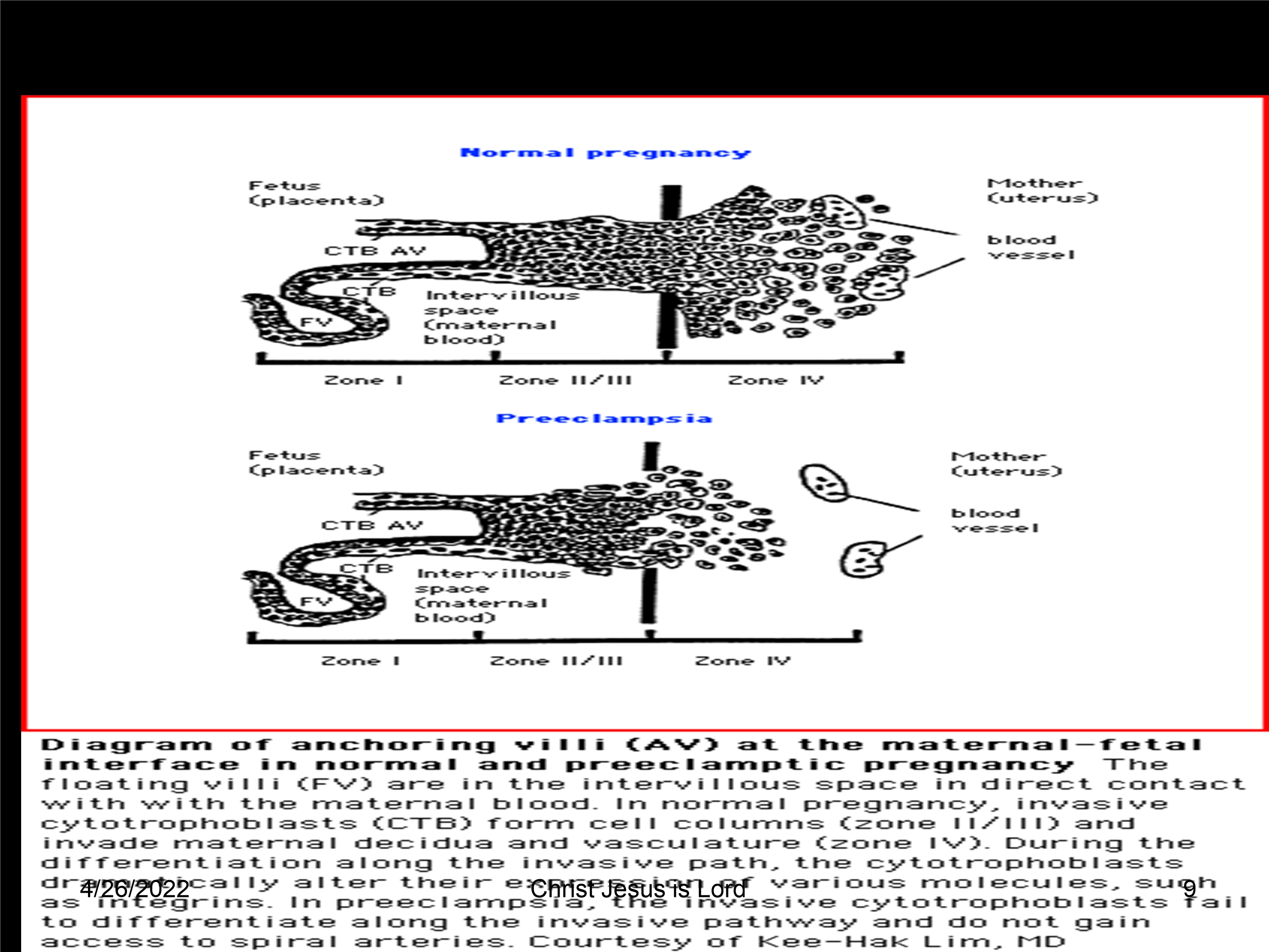 No preview available